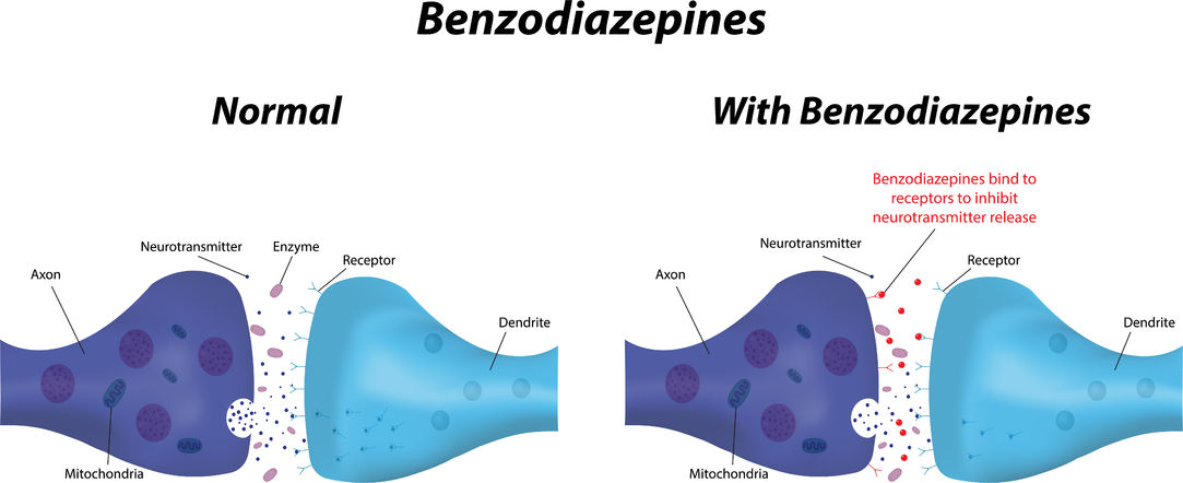 ativan addiction potential of benzodiazepines antidote